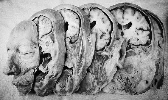 2dec0005e342d4be509c