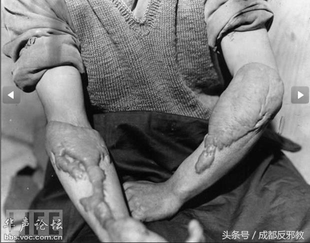 1526351232572b4775f349e