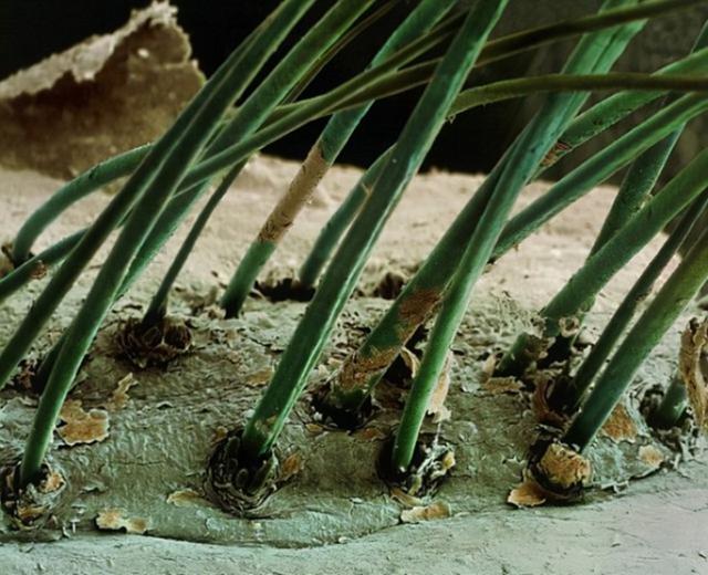 31张显微镜下拍摄的图片，看完感觉世界观被完全颠覆了