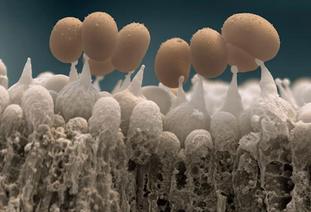 31张显微镜下拍摄的图片，看完感觉世界观被完全颠覆了