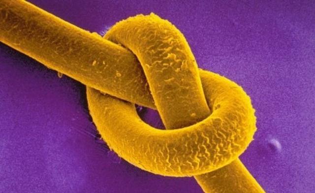 31张显微镜下拍摄的图片，看完感觉世界观被完全颠覆了