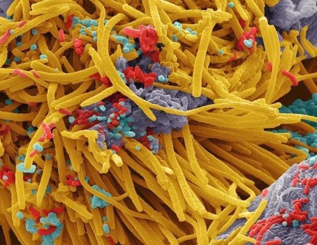 31张显微镜下拍摄的图片，看完感觉世界观被完全颠覆了