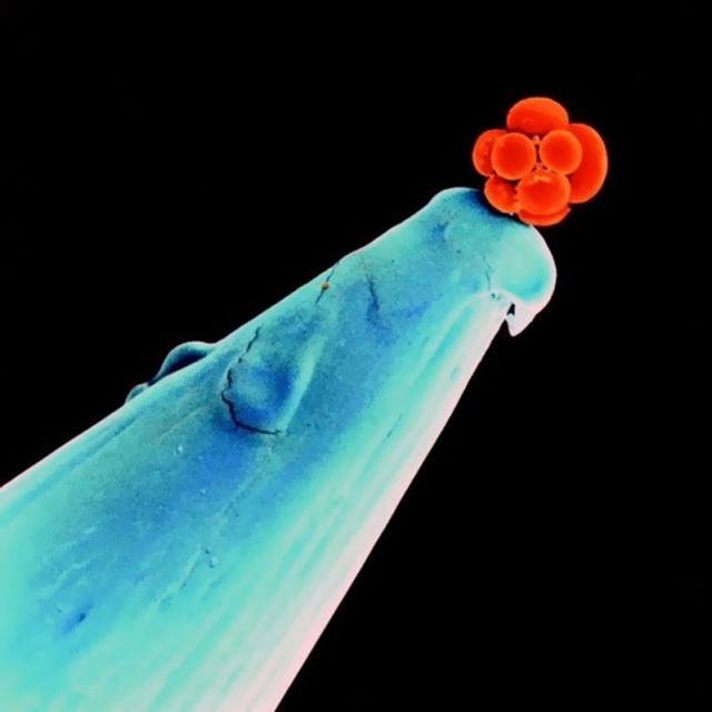 31张显微镜下拍摄的图片，看完感觉世界观被完全颠覆了