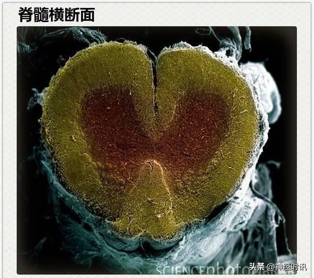 神经解剖（27图）解剖知识必备