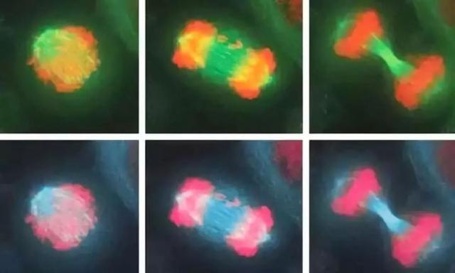 永生的海拉：拥有不死细胞的女人，繁衍细胞质量等同10座帝国大厦