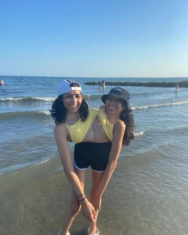 美国连体姐妹一个坚决不嫁，另一个刚结婚，未来永远三人相伴