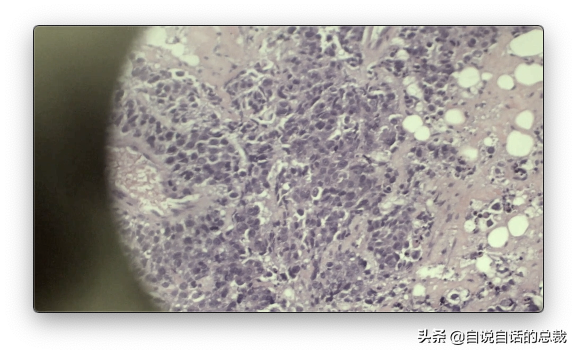 最诡异的器官-皮肤，我们都被这个器官封装在超能力机甲当中