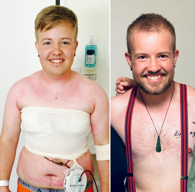 新西兰“男子”直播产子！外国女主播直播生娃，分娩8小时直播全过程